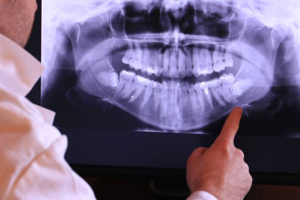 Best Emergency Dental Extractions in Five Points, OH