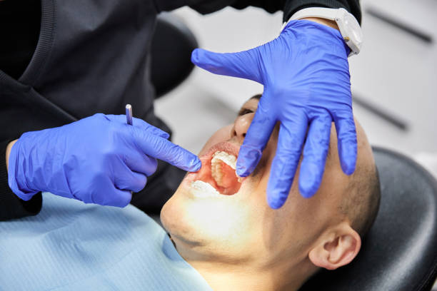 Best Broken or Cracked Tooth Emergency Dentist in Five Points, OH