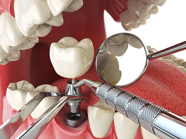 Best Orthodontic Emergency Dentist in Five Points, OH